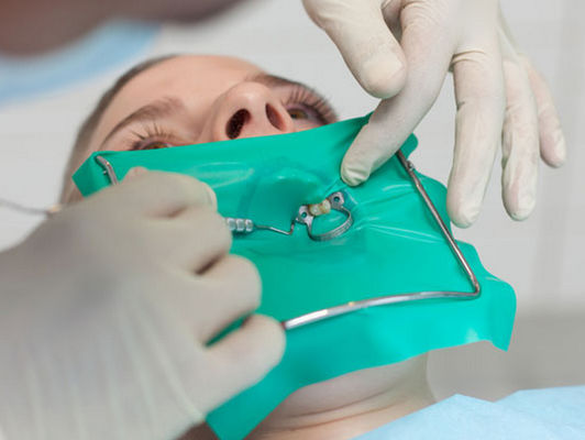 Strati di gomma materiali della diga del lattice del divaricatore dentario puro dentario della diga