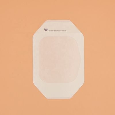 Gesso arrotolato della fasciatura del film medico chirurgico trasparente sterile eliminabile dell'unità di elaborazione