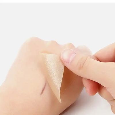 Fogli cicatriziali in silicone, nastro, strisce - Cheloide curativo, cesareo, abdominoplastica - Trattamento delle cicatrici chirurgiche
